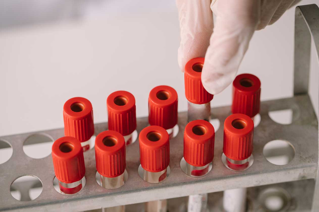 Image of a tray of test tubes